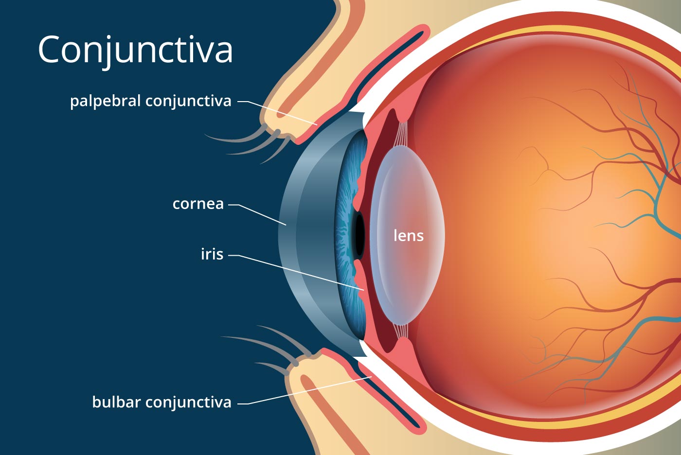 Can A Contact Lens Get Stuck Behind My Eye? Monmouth Eye